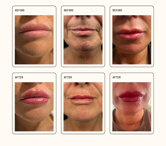 screenshot 2025 11 23 at 08.34.34